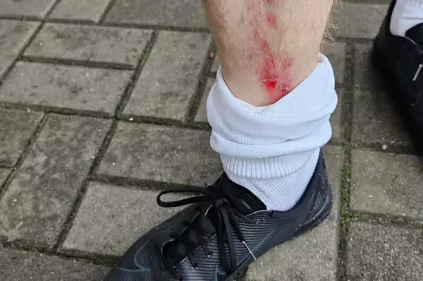 Eine Niederlage, die schmerzt: 1767008872-1763405046=3603826